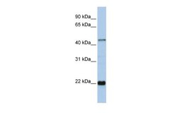 Zinc finger protein 581 Rabbit anti-Human, Polyclonal, Novus Biologicals 0.1 mL | Buy Online | Novus Biologicals | Fisher Scientific